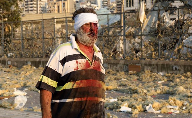Explosão em Beirute deixa milhares de mortos e feridos