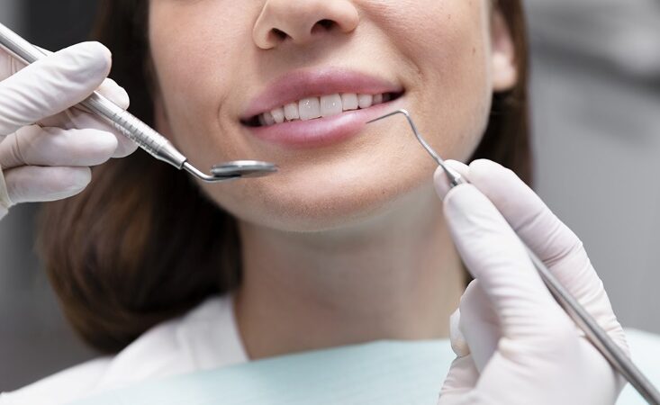 Lentes de contato dental: Mais do que estética, ajudam na reabilitação oral