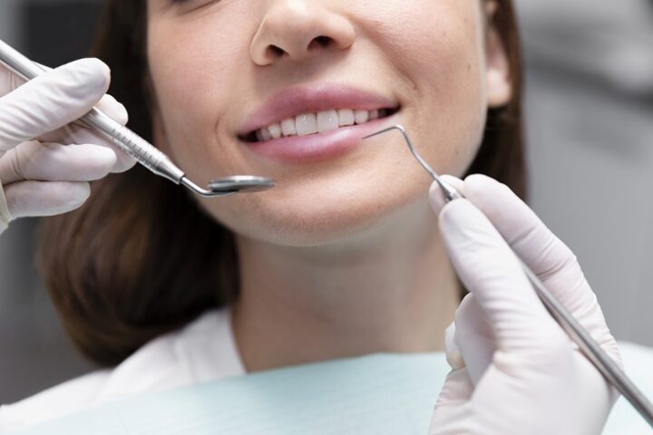 Lentes de contato dental: Mais do que estética, ajudam na reabilitação oral