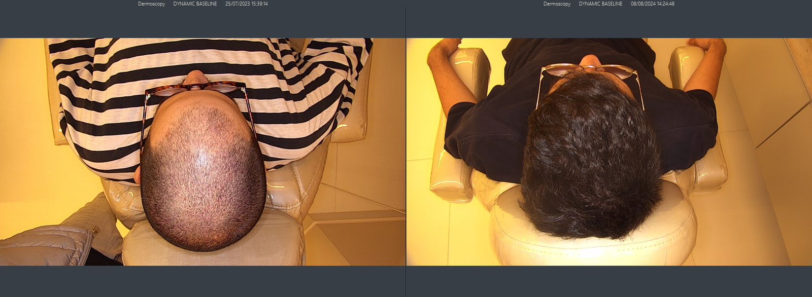 Referência nacional em tratamentos capilares inaugura unidade no Rio