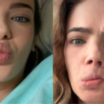 Câncer bucal avança de forma silenciosa no Brasil