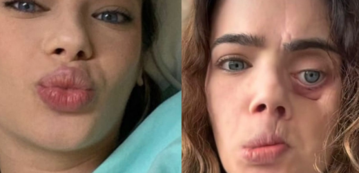 Câncer bucal avança de forma silenciosa no Brasil