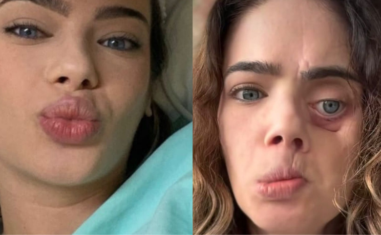 Câncer bucal avança de forma silenciosa no Brasil