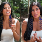 Marciele Albuquerque revela diagnóstico de alopecia